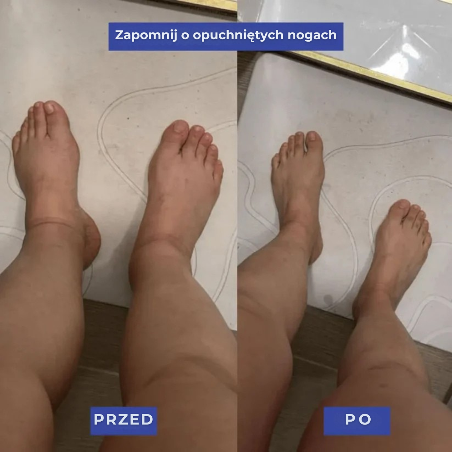 Skarpety uciskowe Nurandi wspomagające regenerację nóg