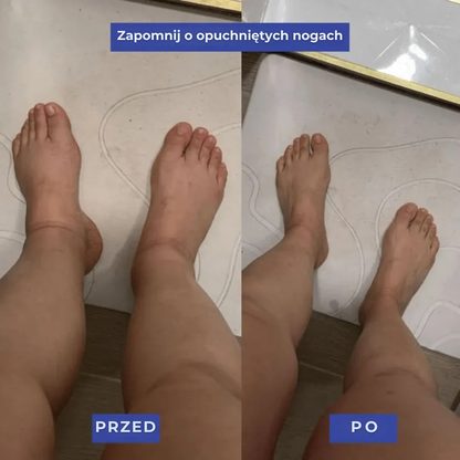 Skarpety uciskowe Nurandi wspomagające regenerację nóg